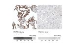 Immunohistochemistry analysis in human lung and liver tissues using AMAb91446 antibody. Corresponding ITGA3 RNA-seq data are presented for the same tissues.