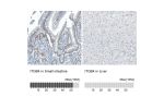 Immunohistochemistry analysis in human small intestine and liver tissues using AMAb91453 antibody. Corresponding ITGB4 RNA-seq data are presented for the same tissues.