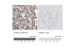 Immunohistochemistry analysis in human duodenum and liver tissues using AMAb91454 antibody. Corresponding ITGB4 RNA-seq data are presented for the same tissues.