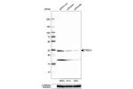 Western blot analysis in U-87MG ATCC cells transfected with control siRNA, target specific siRNA probe #1 and #2, using Anti-TREM1 antibody. Remaining relative intensity is presented. Loading control: Anti-GAPDH.