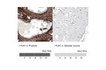 Immunohistochemistry analysis in human prostate and skeletal muscle tissues using AMAb91460 antibody. Corresponding ITGA1 RNA-seq data are presented for the same tissues.