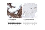 Immunohistochemistry analysis in human prostate and skeletal muscle tissues using AMAb91461 antibody. Corresponding ITGA1 RNA-seq data are presented for the same tissues.