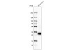Western blot analysis in human cell line SCLC-21H.