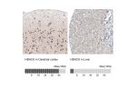 Immunohistochemistry analysis in human cerebral cortex and liver tissues using AMAb91501 antibody. Corresponding HDAC5 RNA-seq data are presented for the same tissues.