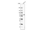 Western blot analysis in human cell line HDLM-2.