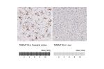 Immunohistochemistry analysis in human cerebral cortex and liver tissues using AMAb91528 antibody. Corresponding TMEM119 RNA-seq data are presented for the same tissues.