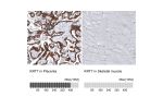 Immunohistochemistry analysis in human placenta and skeletal muscle tissues using AMAb91530 antibody. Corresponding KRT7 RNA-seq data are presented for the same tissues.