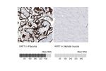 Immunohistochemistry analysis in human placenta and skeletal muscle tissues using AMAb91531 antibody. Corresponding KRT7 RNA-seq data are presented for the same tissues.