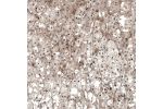 Immunohistochemical staining of human adrenal gland shows moderate nuclear positivity in glandular cells.