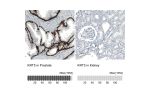 Immunohistochemistry analysis in human prostate and kidney tissues using AMAb91549 antibody. Corresponding KRT5 RNA-seq data are presented for the same tissues.