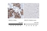 Immunohistochemistry analysis in human kidney and skeletal muscle tissues using AMAb91561 antibody. Corresponding AMACR RNA-seq data are presented for the same tissues.