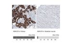 Immunohistochemistry analysis in human kidney and skeletal muscle tissues using AMAb91562 antibody. Corresponding AMACR RNA-seq data are presented for the same tissues.