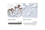 Immunohistochemistry analysis in human rectum and prostate tissues using AMAb91564 antibody. Corresponding KRT20 RNA-seq data are presented for the same tissues.