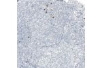 Immunohistochemical staining of human tonsil shows strong cytoplasmic positivity in a small subset of lymphoid cells.
