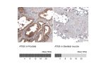 Immunohistochemistry analysis in human prostate and skeletal muscle tissues using AMAb91582 antibody. Corresponding ATG5 RNA-seq data are presented for the same tissues.