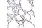 Immunohistochemical staining of human thyroid gland shows strong nuclear positivity in glandular cells.