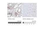 Immunohistochemistry analysis in human testis and skeletal muscle tissues using AMAb91603 antibody. Corresponding SETD2 RNA-seq data are presented for the same tissues.