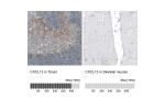 Immunohistochemistry analysis in human tonsil and skeletal muscle tissues using AMAb91629 antibody. Corresponding CXCL13 RNA-seq data are presented for the same tissues.