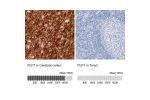 Immunohistochemistry analysis in human cerebral cortex and tonsil tissues using AMAb91639 antibody. Corresponding PLP1 RNA-seq data are presented for the same tissues.