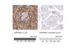 Immunohistochemistry analysis in human liver and skeletal muscle tissues using AMAb91655 antibody. Corresponding SERPINA3 RNA-seq data are presented for the same tissues.
