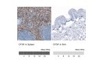 Immunohistochemistry analysis in human spleen and skin tissues using AMAb91667 antibody. Corresponding DYSF RNA-seq data are presented for the same tissues.