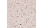 Immunohistochemical staining of human cerebral cortex shows moderate cytoplasmic positivity in microglia.