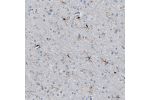 Immunohistochemical staining of human cerebral cortex shows moderate cytoplasmic positivity in microglia.
