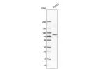 Western blot analysis in human cell line HDLM-2.