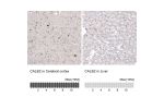Immunohistochemistry analysis in human cerebral cortex and liver tissues using AMAb91812 antibody. Corresponding CALB2 RNA-seq data are presented for the same tissues.
