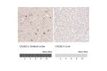 Immunohistochemistry analysis in human cerebral cortex and liver tissues using AMAb91813 antibody. Corresponding CALB2 RNA-seq data are presented for the same tissues.