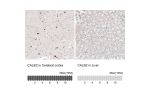 Immunohistochemistry analysis in human cerebral cortex and liver tissues using AMAb91814 antibody. Corresponding CALB2 RNA-seq data are presented for the same tissues.