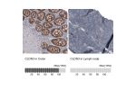 Immunohistochemistry analysis in human colon and lymph node tissues using AMAb91834 antibody. Corresponding CLDN3 RNA-seq data are presented for the same tissues.