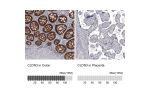 Immunohistochemistry analysis in human colon and placenta tissues using AMAb91835 antibody. Corresponding CLDN3 RNA-seq data are presented for the same tissues.