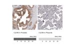 Immunohistochemistry analysis in human prostate and placenta tissues using AMAb91836 antibody. Corresponding CLDN3 RNA-seq data are presented for the same tissues.