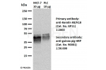 WB with anti-Keratin K8/K18 antibody (Cat. No. GP11, 1:2000) and secondary anti-guinea pig HRP antibody (Cat. No. 90001, 1:50,000), sample MCF7 and PLC whole cell lysate (10 µg)