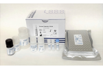 Human Beta-2 Microglobulin ELISA