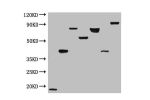 Western Immunoblot analysis of randomly picked 7 differend DDK-tagged overexpressio lysates with CSB-MA000021M0m at 1:2000