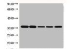 Western blot analysis of Hela (1), Rat brain (2), Rabbit Muscle (3), Sheep Muscle (4), and Mouse brain (5), diluted at 1:10000.
