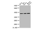 Western blot analysis of Hela (1), Rat brain (2), Mouse brain (3), (A02) diluted at 1:10000.