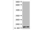 Western blot analysis of Hela, diluted at 1) 1:2000 2) 1:5000