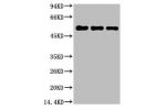 Western blot analysis of 1) Hela, 2) Mouse Brain Tissue, 3) Rat Brain Tissue, diluted at 1:5000.