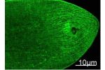 Immunofluorescence Staining of nematode tissue with MYH mouse mAb (11C2) diluted at 1:100. (Provide by Tsinghua University) .