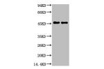 Western blot analysis of Rat Brain Tissue, diluted at 1:5000.