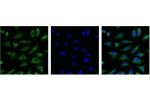 IF analysis of Hela with antibody (Left) and DAPI (Right) diluted at 1:100.