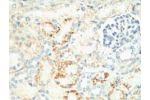 IHC staining of Mouse Kidney tissue, diluted at 1:200.
