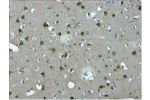 IHC staining of Human brain tissue paraffin-embedded, diluted at 1:200.