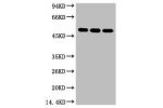 Western blot analysis of 1) 293T, 2) HepG2, 3) Hela, diluted at 1:3000.