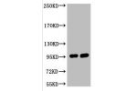 Western blot analysis of 1) Hela, 2) 293T, diluted at 1:2000.