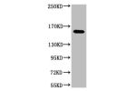 Western blot analysis of 1) Hela, 2) 293, 3) Jurkat, diluted at 1:2000.