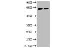 Western blot analysis of 1) Hela, 2) HepG2, diluted at 1:2000.